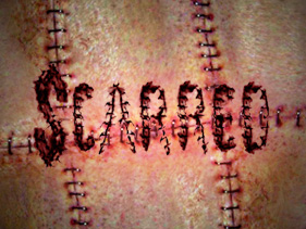scarred_281x211